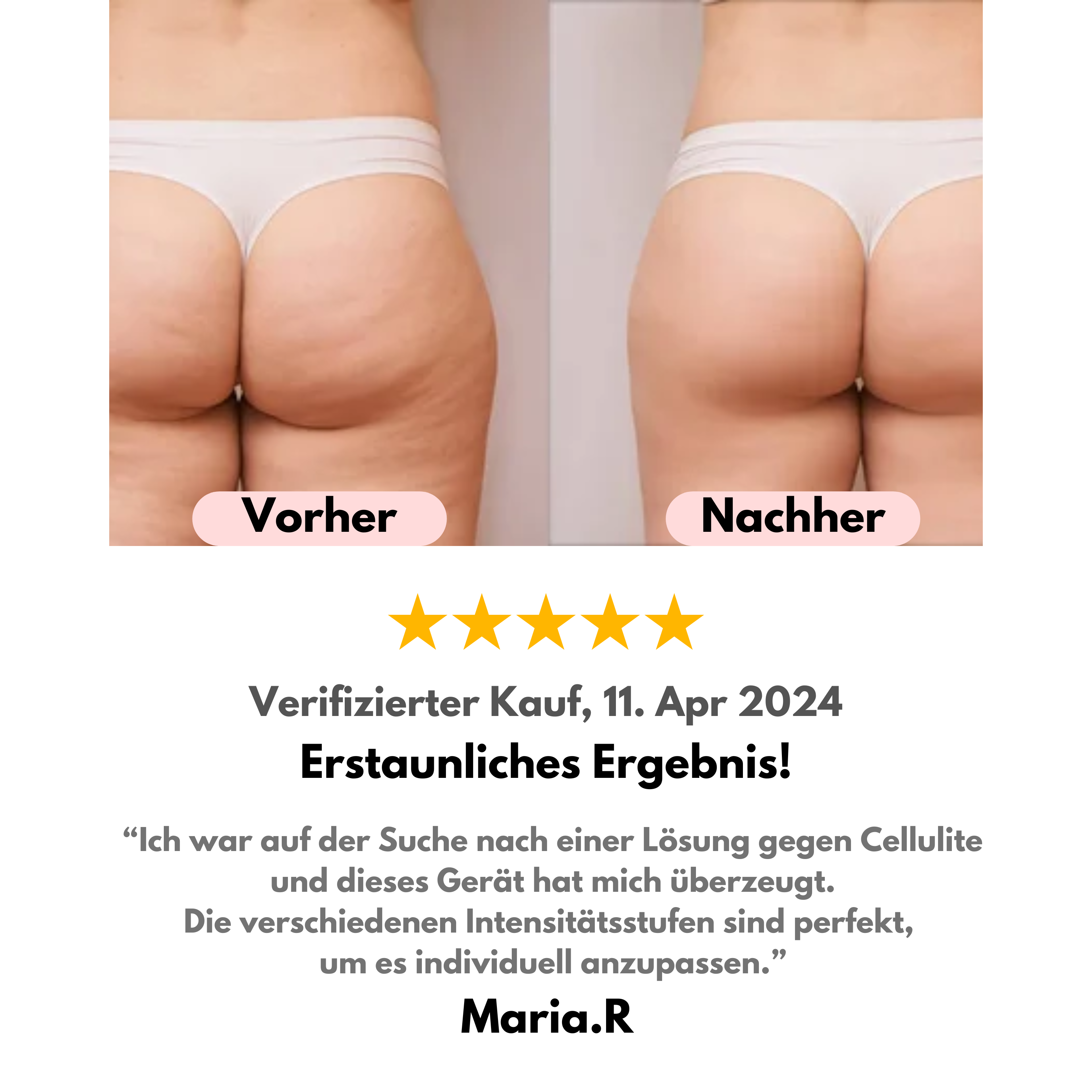 CelluLift Pro - Nie wieder Cellulite!